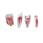 Orodeka 3D Teeth